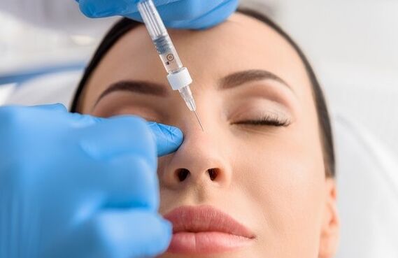 The non -surgical rhinoplasty method
