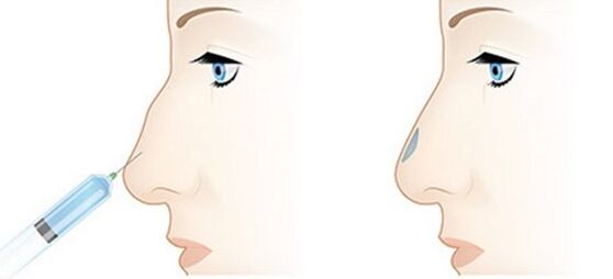 The procedure allows you to adjust multiple problems