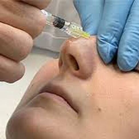 procedure