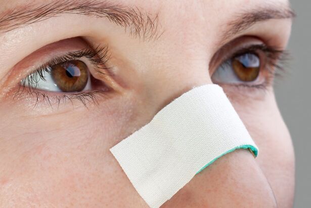 possible complications after nasal septum correction