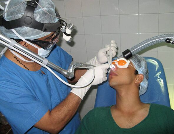 septum correction with laser scalpel