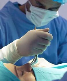 performing closed nose plastic surgery