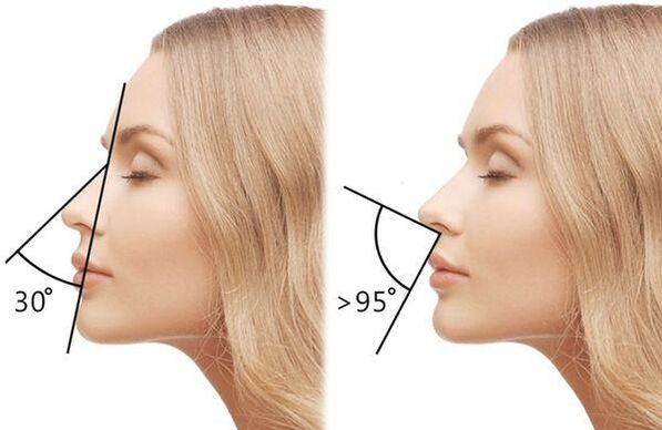 nose angle measurement